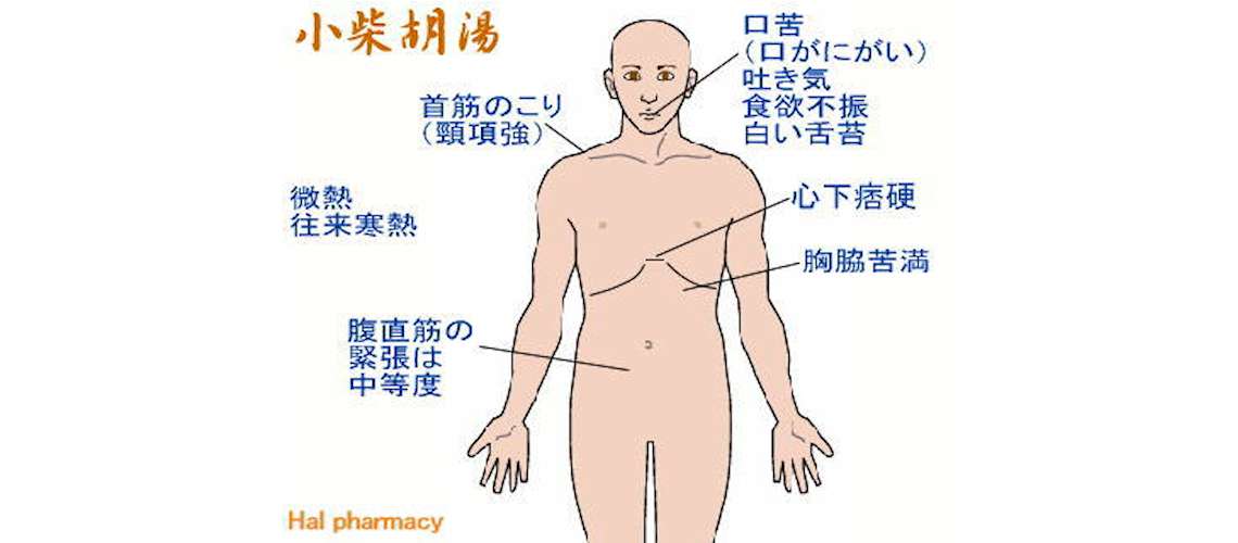 ツムラ企業レポート:小柴胡湯事件