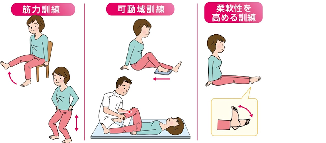 変形性膝関節症（初期の痛み-）