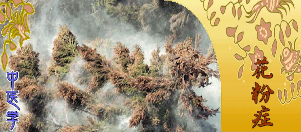 花粉症（Top-）
