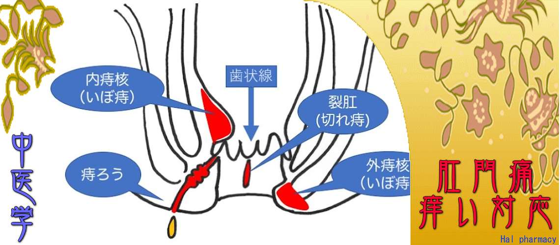 肛門痛痒い（Top-）