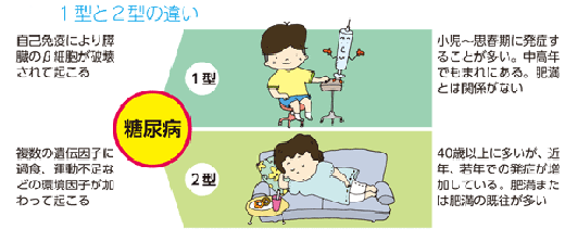 １型と2型の相違