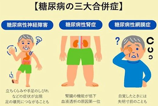 三大合併症
